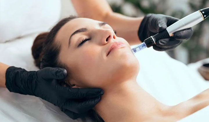 laser skin treatments