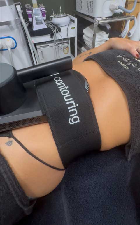 Summer body contouring